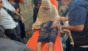 Wanita korban penyiksaan yang diduga dilakukan oleh oknum polisi