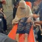 Wanita korban penyiksaan yang diduga dilakukan oleh oknum polisi